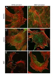 Anti-Talin-1 antibody [97H6] used in Immunocytochemistry/ Immunofluorescence (ICC/IF). GTX38973