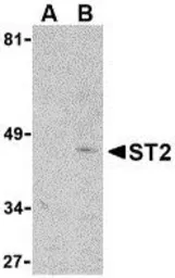 Anti-ST2 antibody, N-term used in Western Blot (WB). GTX39035