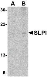 Anti-SLPI antibody used in Western Blot (WB). GTX39074