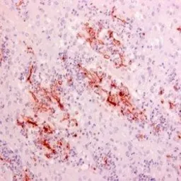 Anti-Rhizopus arrhizus antibody [WSSA-RA-1] used in IHC (Paraffin sections) (IHC-P). GTX39191