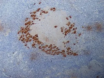 Anti-Progesterone antibody [9B4] used in IHC (Paraffin sections) (IHC-P). GTX39285