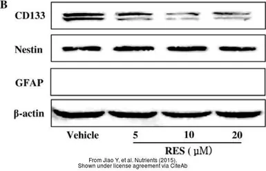 Anti-Nestin antibody used in Western Blot (WB). GTX39578
