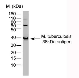 Anti-Mycobacterium tuberculosis 38 kDa antibody [BGN/1209/3875] used in Western Blot (WB). GTX39621
