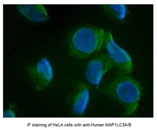 Anti-LC3A/B antibody, N-term used in Immunocytochemistry/ Immunofluorescence (ICC/IF). GTX39752
