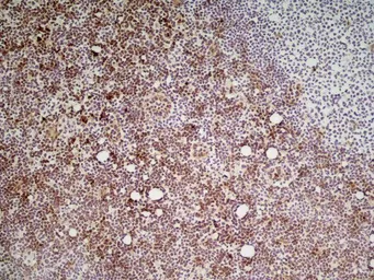 Anti-Ly6c antibody [ER-MP20] used in IHC (Frozen sections) (IHC-Fr). GTX39791