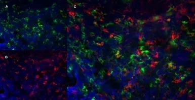 Anti-Ly-6B.2 antibody [7/4] used in IHC (Frozen sections) (IHC-Fr). GTX39793
