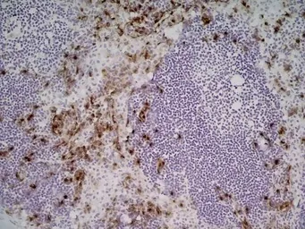 Anti-Ly-6B.2 antibody [7/4] used in IHC (Frozen sections) (IHC-Fr). GTX39793