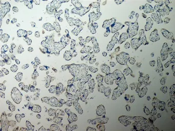 Anti-Inhibin alpha antibody [R1] used in IHC (Paraffin sections) (IHC-P). GTX40216