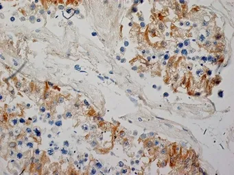 Anti-Inhibin alpha antibody [R1] used in IHC (Paraffin sections) (IHC-P). GTX40216