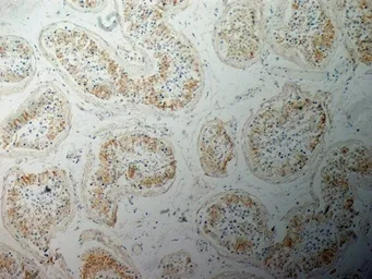 Anti-Inhibin alpha antibody [R1] used in IHC (Paraffin sections) (IHC-P). GTX40216
