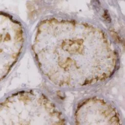 Anti-Inhibin alpha antibody [R1] used in IHC (Paraffin sections) (IHC-P). GTX40216