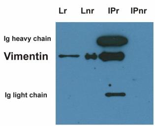 Anti-Vimentin antibody [VI-10] used in Immunoprecipitation (IP). GTX40346