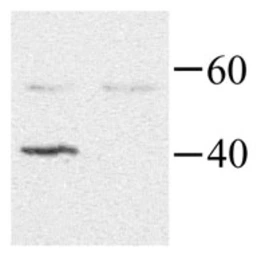 Anti-GNAI2 antibody used in Western Blot (WB). GTX40392
