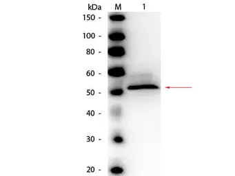 Anti-Hexokinase antibody (HRP) used in Western Blot (WB). GTX40547