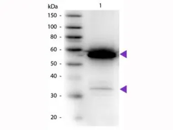 Anti-alpha Amylase antibody (HRP) used in Western Blot (WB). GTX40567