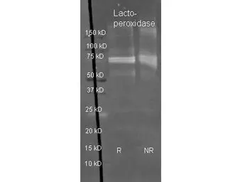 Anti-Carboxypeptidase Y antibody (HRP) used in Western Blot (WB). GTX40574