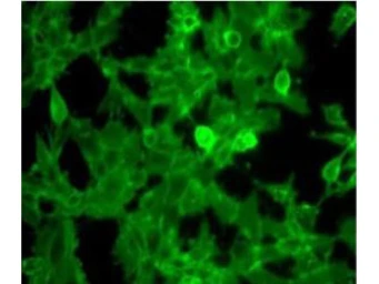 Anti-beta 2 Microglobulin antibody (HRP) used in Immunocytochemistry/ Immunofluorescence (ICC/IF). GTX40576
