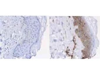 Anti-beta 2 Microglobulin antibody (HRP) used in IHC (Paraffin sections) (IHC-P). GTX40576