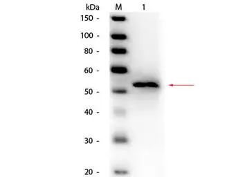 Anti-Glycerol kinase antibody (HRP) used in Western Blot (WB). GTX40600
