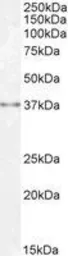 Anti-Sprouty 1 antibody, C-term used in Western Blot (WB). GTX41020