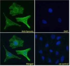 Anti-Sprouty 1 antibody, C-term used in Immunocytochemistry/ Immunofluorescence (ICC/IF). GTX41020