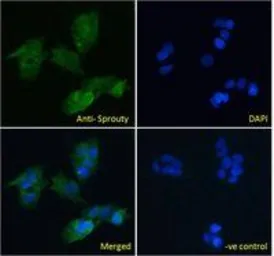 Anti-Sprouty 1 antibody, C-term used in Immunocytochemistry/ Immunofluorescence (ICC/IF). GTX41020