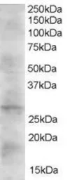 Anti-DKK2 antibody, C-term used in Western Blot (WB). GTX41187