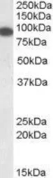 Anti-ELKS antibody, N-term used in Western Blot (WB). GTX41192