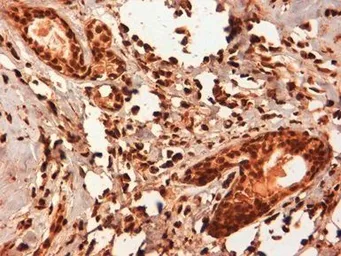 Anti-Estrogen Receptor beta 5 antibody [5/25] used in IHC (Paraffin sections) (IHC-P). GTX41212