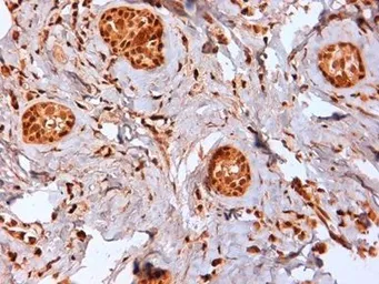 Anti-Estrogen Receptor beta 2 antibody [57/3] used in IHC (Paraffin sections) (IHC-P). GTX41214