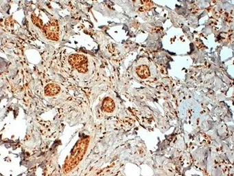 Anti-Estrogen Receptor beta 2 antibody [57/3] used in IHC (Paraffin sections) (IHC-P). GTX41214