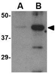 Anti-Avian Influenza A virus H5N1 HA (Hemagglutinin) antibody used in Western Blot (WB). GTX41297