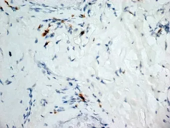 Anti-Dectin-1 antibody [2A11] used in IHC (Frozen sections) (IHC-Fr). GTX41467