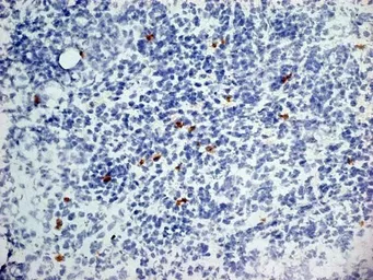 Anti-Dectin-1 antibody [2A11] used in IHC (Frozen sections) (IHC-Fr). GTX41467