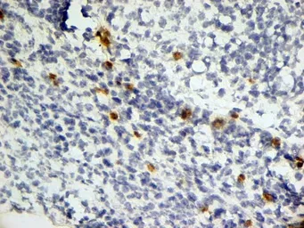 Anti-Dectin-1 antibody [2A11] used in IHC (Frozen sections) (IHC-Fr). GTX41467