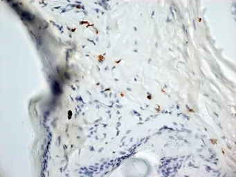 Anti-Dectin-1 antibody [2A11] (Low endotoxin, azide free) used in IHC (Frozen sections) (IHC-Fr). GTX41471