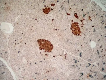 Anti-Chromogranin A antibody [LK2H10] used in IHC (Frozen sections) (IHC-Fr). GTX41688