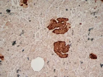 Anti-Chromogranin A antibody [LK2H10] used in IHC (Frozen sections) (IHC-Fr). GTX41688