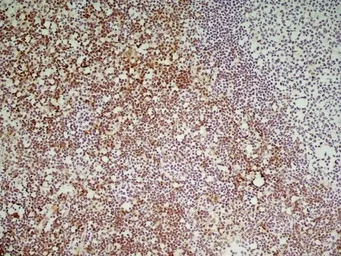 Anti-CD8 antibody [YTS169.4] used in IHC (Frozen sections) (IHC-Fr). GTX41817