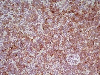 Anti-CD8 antibody [YTS169.4] used in IHC (Frozen sections) (IHC-Fr). GTX41818