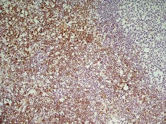 Anti-CD8 antibody [YTS169.4] used in IHC (Frozen sections) (IHC-Fr). GTX41818