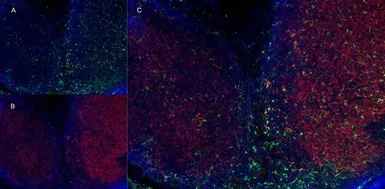 Anti-CD8 alpha antibody [YTS105.18] (Low endotoxin, azide free) used in IHC (Frozen sections) (IHC-Fr). GTX41819