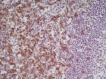 Anti-CD8 alpha antibody [YTS105.18] (Low endotoxin, azide free) used in IHC (Frozen sections) (IHC-Fr). GTX41819