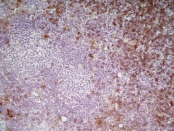 Anti-CD8 alpha antibody [YTS105.18] (Low endotoxin, azide free) used in IHC (Frozen sections) (IHC-Fr). GTX41819
