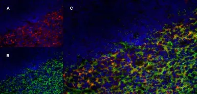 Anti-CD70 antibody [Bu69] used in IHC (Frozen sections) (IHC-Fr). GTX41859