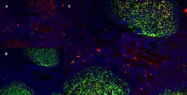 Anti-CD70 antibody [Bu69] used in IHC (Frozen sections) (IHC-Fr). GTX41859
