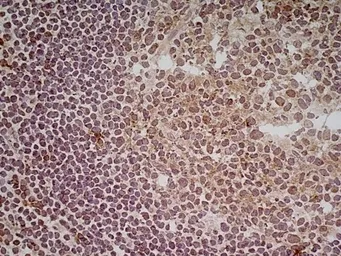 Anti-CD70 antibody [Bu69] used in IHC (Frozen sections) (IHC-Fr). GTX41859