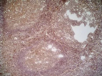 Anti-CD70 antibody [Bu69] used in IHC (Frozen sections) (IHC-Fr). GTX41860