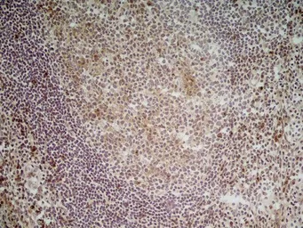 Anti-CD70 antibody [Bu69] used in IHC (Frozen sections) (IHC-Fr). GTX41860