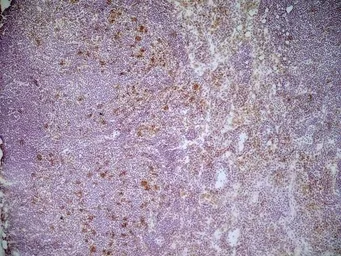 Anti-CD68 antibody [FA-11] used in IHC (Frozen sections) (IHC-Fr). GTX41864